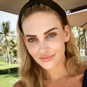 Stephanie Pratt Instagram - I got some new freckles 😁🤓