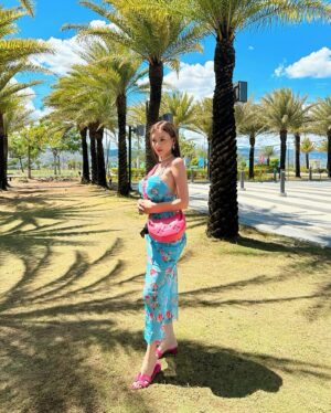 Sunshine Guimary Instagram - ☀️Sunburn Everyday!