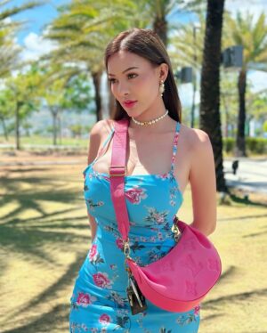 Sunshine Guimary Instagram - ☀️Sunburn Everyday!