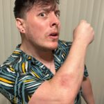 Thomas Sanders Instagram - Not a big deal 🐍 (W/ @quildarling & @domgoldofficial; & help by @lovelyyuniverse) #comedy #relatable #snake #bite #metalgearsolid