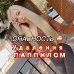 Valeria Lukyanova Instagram – Зрелище не для слабонервных! 
Как удалить папиллому в домашних условиях! 

Советы из интернета порой наносят нам вред , и могут вызвать большие проблемы , поэтому необходимо обращаться к квалифицированному специалисту у которого большой опыт работы! 

Ко мне обратился человек который сжег себе кожу посоветую доктора Берга при уничтожении папиломы в домашних условиях! 

Обычно это происходит просто : перевязал ниткой папиному ,  помазал специальным раствором – она отпала и никаких проблем! Именно по такому совету я удалила свои папилломы и у меня все было в порядке! 

Но необходимо учитывать очаг ,  если он  находится в подмышечной впадине или  та.  где потеете – совершенно другой вопрос! 

Все заботящиеся о здоровье люди знают , что папилома и родинка – это опасность онкологии в будущем и от этого нужно избавляться незамедлительно! Внизу у нас под папиломой  или родинкой многоветвистые пути  мицелия, и уничтожив очаг – мицелий  постепенно отмирает ! 

Но стоит учитывать важную вещь: 

всё это нужно делать со специалистом и под присмотром паразитолога! Т к  данная ткань поражена грибком , из-за этого регенерация снижена на 80 % и это все очень медленно заживает и нужно понимать , чем это нужно обрабатывать , чтобы не нанести непоправимый вред! 
 Продолжение истории и чем все закончилось читайте в  моей группе по ссылке в профиле! ⛔️ расскажите у вас были такие случаи и чем все закончилось , поделитесь? #паппилома #родинки #грибок #мицелий #паразиты #паразитоз #удалениепаппилом #удалениепаппиломы #грибки #паразитология #микробиолог