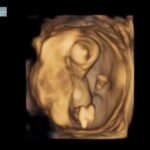Whitney Cummings Instagram – In these pix I am with child. And there’s a baby in me too. Human pup coming December. All tour dates in 2023 still happening I just may fall over a couple times.
