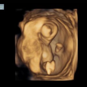 Whitney Cummings Instagram - In these pix I am with child. And there’s a baby in me too. Human pup coming December. All tour dates in 2023 still happening I just may fall over a couple times.