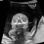 Whitney Cummings Instagram – My favorite pic of my babies face so far. Help me name this monster. Rusty? Dusty? Dolly?