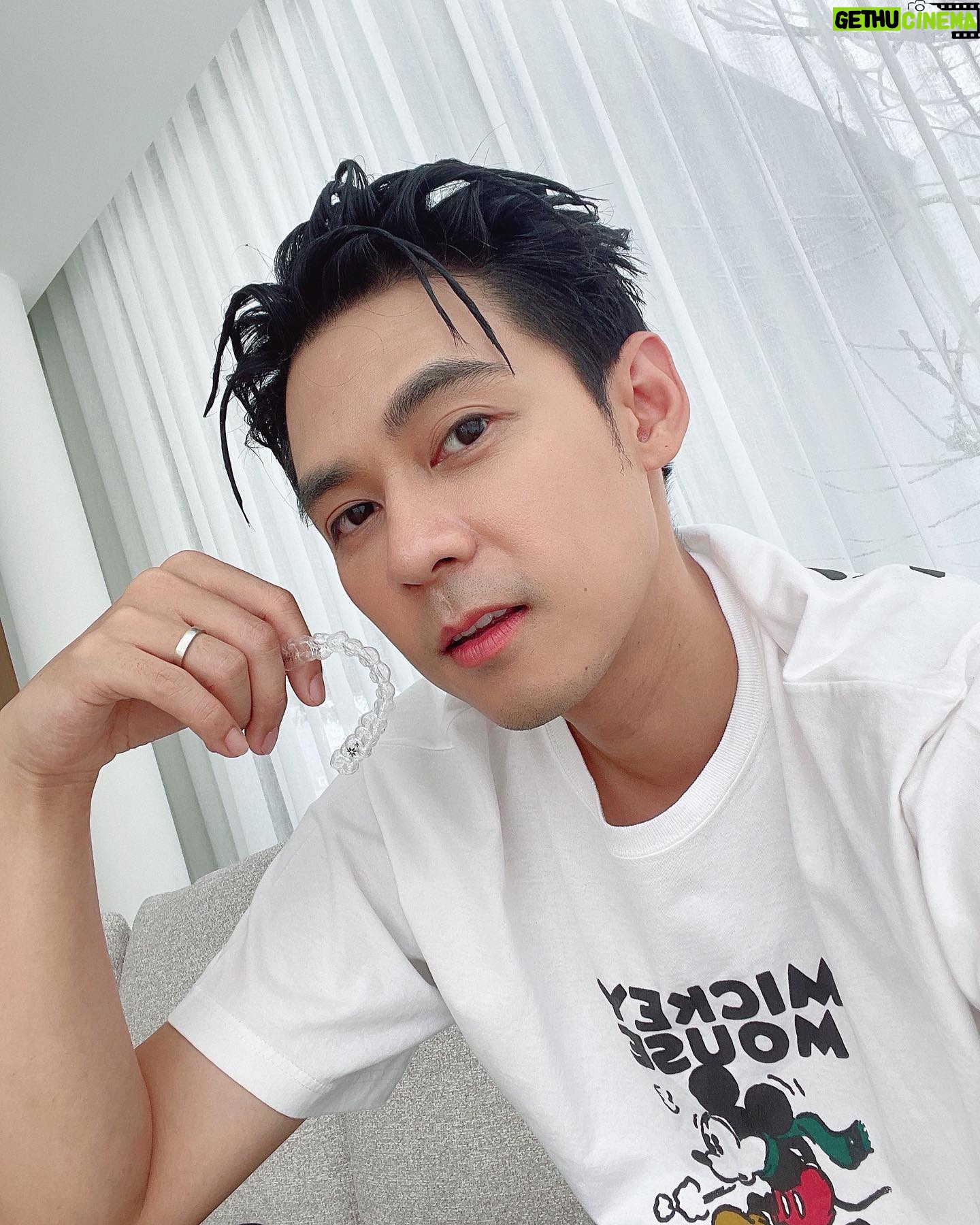 Worrawech Danuwong Instagram - จัดฟันใส Invisalign กับ @tdhdental มาพักหนึ่งแล้ว เข้าใจเลยว่าทำไมหลายคนถึงแนะนำมาว่าจัดฟันใสต้องที่นี่เท่านั้น เพราะพอได้มาเองแล้ว คุณหมอเก่งมากๆ ได้พูดคุยถึงความต้องการของเราจริงๆ มีการใช้เทคนิคเฉพาะ เพื่อวิเคราะห์ใบหน้าของเราด้วยครับ ขนาดเพิ่งผ่านไปไม่กี่สัปดาห์ มั่นใจเวลายิ้มมากขึ้นเลย 😁💙 และจะบอกว่ามาทำฟันที่นี่ทีไรรู้สึกเป็นกันเองสุดๆเลยครับ #ThonglorDentalHospital #Invisalign #InvisalignTH #จัดฟันใสInvisalignต้องTDH