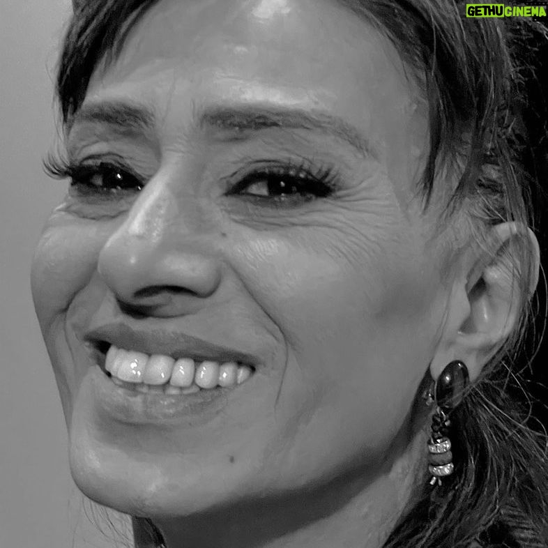 Yıldız Tilbe - 76.2K Likes -
