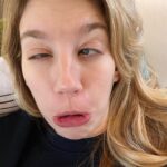 Yael Grobglas Instagram - Anyone else with the damn winter sniffles ?