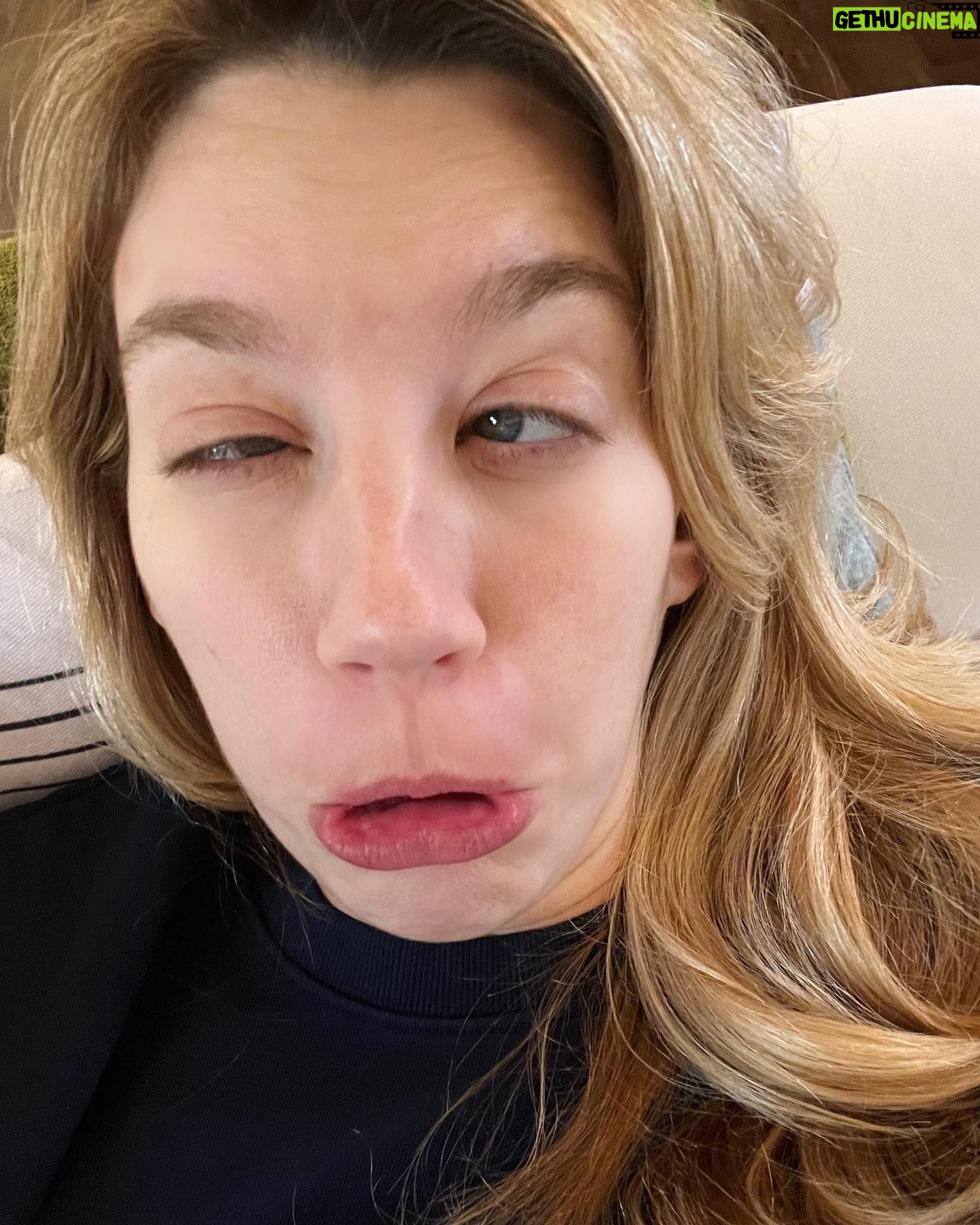 Yael Grobglas - 28.5K Likes - Anyone else with the damn winter sniffles ?