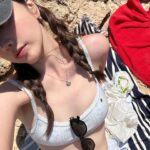 xooos Instagram – Sunburn🏖️