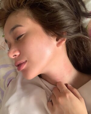 Ade Yunita Instagram - bangun tidur tb2 merah badan juga kenapa ya 🥲 sepertinya tungau 😞 but i feel pretty so yeaaa
