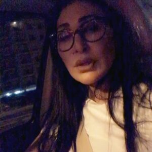 Ahlam Hassan Instagram - الف الف شكر لعيادة سيلويت 
على كل شي 
شلت الفيلر عندهم .. الدكتور شغله جدا حلو وعلى مستوى عالي .. معاملتهم جدا راقيه .. د. سحر الف شكر لج لو ما تشجيعج جان ما سويت العمليه ..
حبايبي اللي يدشون علي خاص بحطلكم اكاونتهم عشان تستفيدون 
وانا جدامكم اكبر مثال 
@silhouette_rmc 👈🏻👈🏻👈🏻