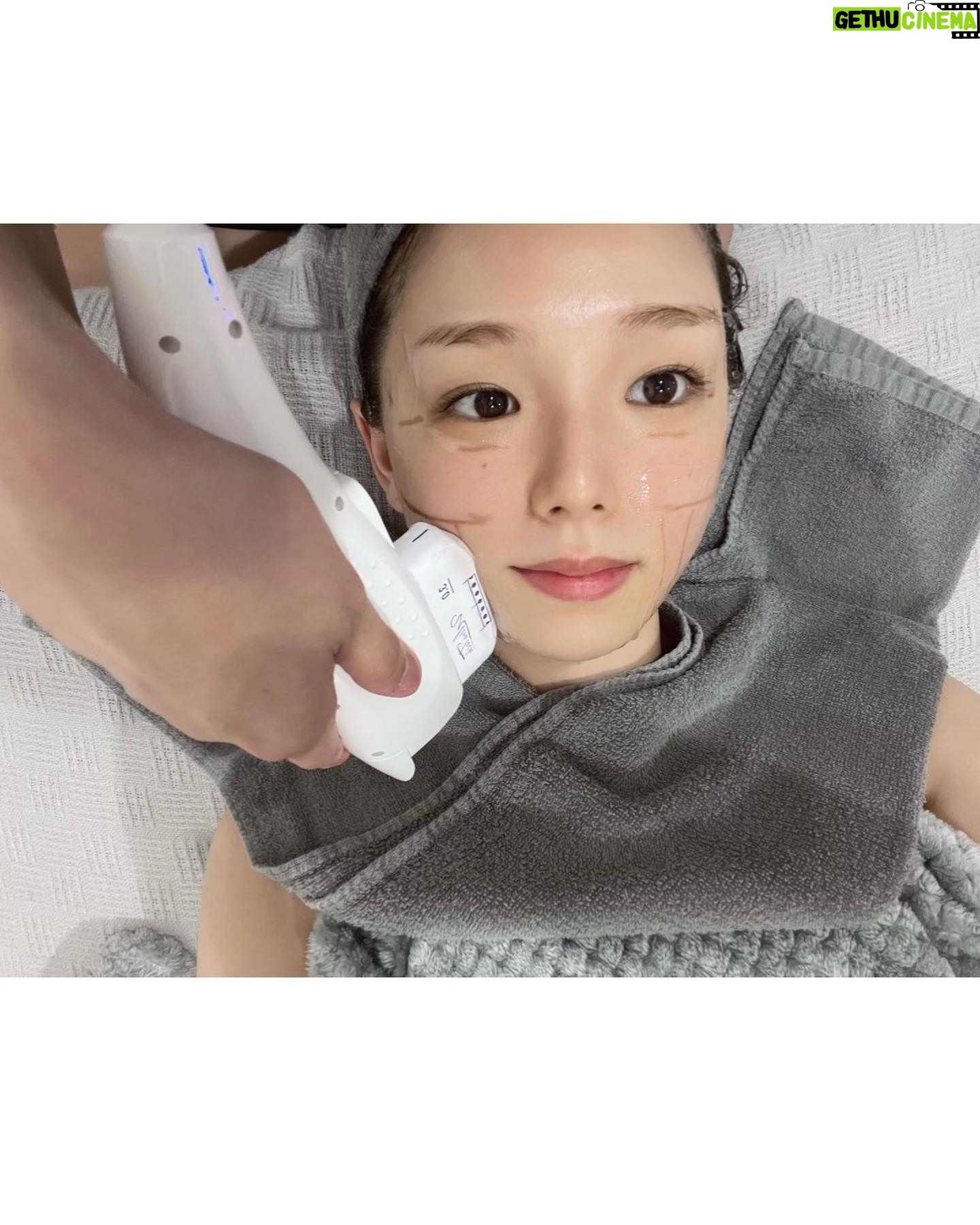 Ai Shinozaki Instagram - ・ 今日は美容dayという事で @lif_azabujyuban に行ってきました。 今回の施術は、 〈HIFU〉と〈STEM EXO TREATMENT〉 エアガンのような機械でお肌にエクソソームを入れ込んでくれるんだけど、痛そうに見えて全く痛くないんだよ☺️ 明日撮影だけど、 ダウンタイムもなくてありがたい。。♡ また行きたいな🤍 #LIF麻布十番 #stemexotreatment #ステムエクソトリートメント #エクソソーム #ヒト幹細胞 #ウォートンジェリー由来臍帯血幹細胞 #再生美容 #1枚目の写真は関係ない