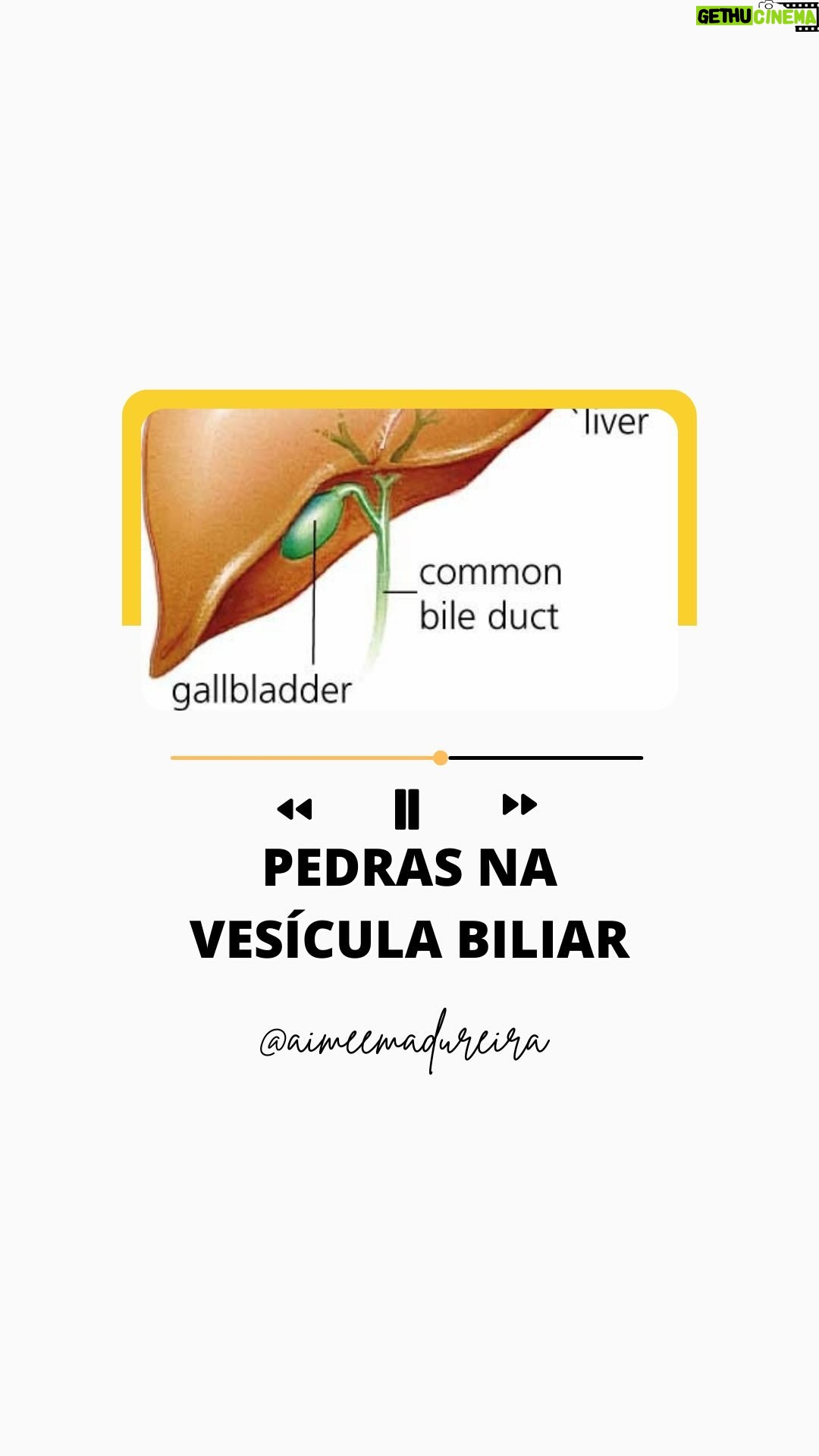 Aimée Madureira - 103 Likes - Pedras da vesícula no microscópio! 🔬
No super detox do @spamariabonitaipanema @spamariabonita @spazziano conseguimos eliminar muitas pedras da vesícula através do processo de desintoxicação único e diferenciado, o que reduz inclusive a necessidade do processo cirúrgico de remoção da vesícula!