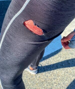 Aimee Teegarden Instagram - Feeling lucky to still be walking right now after being hit by a car in the middle of a crosswalk this afternoon. Please pay attention  while driving and put down your phone, it isn’t worth it...(highlight of this ordeal was getting chunks of material tweezed out from the gash in my leg 🤮🤕)