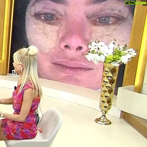 Akasya Asıltürkmen - 3.1K Likes - Hemen böbreklerine kadar anlat her şeyini Akasya e mi! 🥹🫠🫠🫠Şaka bir yana tam yüz operasyonumun üçüncü yıl dönümü. Hala çok memnunum.
🥲🥲🥲Kendi paylaşımımla başımı yakmış ama sonra bununla da eğlenmeyi başarmıştım.
🥑🥑🥑Tekrar ediyorum; çok zordu süreç ama şimdi olsa yine yaptırırım. İnsan kendini iyi hissedecek arkadaş! Ötesi hikaye.
