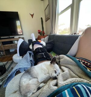 Alexandra Johnson Instagram - first social outing today after getting a new ACL, and a tribute to my cutest nurses. the first few days were some of the hardest of my life, but each day has been slightly better. the mood and optimism have been turbulent but the biggest thing this whole mess has shown me is how amazing the people in my life are. 

so many people have done so much for me this last month, from PT, to advice, helping with the dogs, piggybacks, or just reaching out, to sneaking emergency ibuprofen into my section at Taylor Swift (@leici_lady.) you guys are all fucking incredible and there’s no way i could’ve done this without you. so thanks. 

@melinacostanza @trish_johnson57 @dr.amy.fruge.dpt @natashabarnes @berman_craig @briestrangcheez @gregnowicki_ @julesiecho @timkemple @cynthiamartinezmeh  @amurica3 @johncollinson and especially Katey B and Dr. J 🐪 even tho they don’t have insta. and everyone who’s reached out that shit doesn’t go unnoticed. 🖤🙏🫶