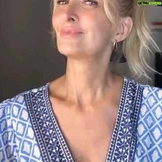 Amalia González - 764 Likes - Mi imprescindible de todos los días es el serum 55 Efecto Lifting de Ydaris. *Diseñado especialmente para mujeres exigentes*
Con una potente fórmula enriquecida con Sesaflash®️, Cobiolift®️, Ácido Hialurónico de bajo peso molecular y Pro Retinol, este serum es mi aliado perfecto para combatir arrugas profundas, manchas y pérdida de firmeza💆♀️
¿Cuál es el secreto para obtener resultados duraderos? Usarlo todas las mañanas con la piel limpia y antes de dormir para lograr una piel visiblemente más suave, firme y luminosa✨
#brumasantiage #mujeresde60 #mujeresde50 #beautytips #skincaretips #mujeresde40 #antiage #cuidaturostro