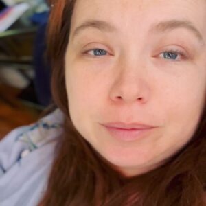 Amanda Fuller Instagram - A year ago today (well, yesterday now cause I accidentally deleted this whole damn thing and had to start all over again- 👋🏼 it’s me), I woke up from my first excision surgery for Endometriosis. They removed 27 endometrial masses (cysts etc) along with my appendix which was destroyed by it. My external scars have healed quite nicely (thank you docs), but the devastating truth is, my journey is only beginning again. I wish I could say I was cured. There is no cure. And after a few months of relief I had never even dreamed of (and having pain free, actually “normal”-ish periods for the first time in my life), my flare ups have come back with a vengeance. Constant and relentless. So, after waiting 25 long years for a proper diagnosis and any sort of treatment, I begin again. This is endometriosis. At least this time, I finally know what I am dealing with. For the most part. And I am sooooo not alone in this, which is why…

I thought what better day than today to honor this journey by announcing that I am starting a podcast. I know, 🙄. I certainly never thought I would be the one to join the podcast club, but… We need exposure, awareness, research, and allies to help the people born with uterus’ who suffer this monstrous disease get the help they so desperately deserve. We need an army. I have a responsibility to help build that army in any way I can. So, I present to you: @thatEndoPod - where I will share the unique and necessary stories of #endowarriors as well as interview experts in the field. We need each other. Episode one, where I will share my own story in full detail for the first time, will be released a month from today, June 27th 2023. Until then, be as well as you can be…and keep fighting.

With all my love-
a
 
#1. today 
#2. a year ago tomorrow
#3. a year ago tomorrow 
#4. a year ago today
#5. art by yours truly, from the notes app, cause I’m fancy like that