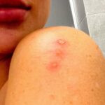 Andrea Pomeje Instagram – KAMBO 🐸 – moje největší vystoupení z komfortní zóny za celý život… NIKDY jsem pro sebe a své zdraví neudělala nic tak VELKÉHO! 💫 Nikdy jsem necítila tak intenzivně svoji smrtelnost a věčnost zaroveň.. 

NO TAKHLE, kdybyste věděli co všechno se ve mě odehrávalo něž jsem se odhodlala jít a odevzdat se.. první termín jsem zrušila! Hodně prace! Jasný! Normálně jsem se po💩… a pak jsem měla dalších 10 dní, kdy jsem ten svuj strach prodloužila… ale chodily mi tam opravdu důležitý setkání se sebou samotnou… dokonce jsme si řekly s Lianou, moji terapeutkou, že si uděláme místo klasické terapie před Kambem jen hodinovou manifestaci, ale behem toho jsme narazily na mojí největší slabinu a to je SMRT! .. Kambo je o smrti! Když vám je aplikovaný jed z žáby do vypálené rány, tak vase telo, u mě to bylo do minuty, si myslí, že umírá… potom přichází fáze, kdy se začne burcovat celý imunitní systém! Je vám strašně špatně! Otevírá se podvědomí a vy začnete zvracet a chapat co konkretne je to co dáváme pryc.. tezce se mi to vysvětluje.. telo už není pod vaší vládou a převládá DUŠE! .. v tu chvíli se obnovuje spolu s imunitním systémem i ten nervový… brní ruce, nohy… křeče…obličej natekly a tělo neovladatelný.. ten proces je EXTREM !!!!!!! 🖤 

Děkuji moc @vojtech_chladek za tvou citlivost a umožnění něco takového prožít… 🙏🏼 

Přetáhni na druhy slajd: Dokument – ČT1 – Samani odcházejí – cely ho najdete na YouTube 🎥

Ps: Veškeré pocity jsou individuální a budu pokračovat v tom abych vám řekla víc…