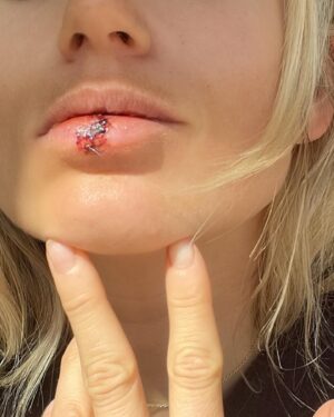 Anna Gasser Instagram - Powder 1 - Anna 0 🫦. I’ll be back for revenge . 
📸 @s4ni