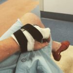 Annabel Crabb Instagram - At Canterbury Hospital’s hand clinic for further assistance with an injury sustained to my paw on Boxing Day while blithely using it to tamp down a loaded kitchen bin, unaware that it contained a broken glass. Yes, I know: Dumb. A common injury apparently. Anyway, big shout out and thank you to the ED team at Canterbury that night for skillful and good humoured assistance, and to the surgeon / anesthetist / theatre crew who worked VERY late sewing me up, and last but not least kind Lowanna on Acacia Ward who found me a charger when my phone expired. Oh also plus Jess who has taught me things I did not know about hand musculature and nerve systems. Satisfied customer ❤️