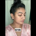 Ashmitha Instagram - Here’s a quick before and after 😍 I know the lighting is different but you can see a clear difference in pigmentation & spots on the side of my cheeks in the Before & After DST or Deep Skin Therapy is one of my favorite treatments @raha.derma Think of it as a facial promax, but now they’ve upgraded it even further , it removes the dull & dusty layer on your skin & gives an instant fresh look with a shine! Try it out @raha.derma and thank me later 😎 #skin #skintherapy #shine #shining #glossyskin #glassskin #realisticskingoals #happy #raha #rahaderma #yay #fool #smile #pretty #skintreatment #plump #hydrated #love #telugu #teluguactress #ashtrixx #nofilter