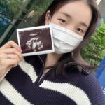 Baek A-yeon Instagram - 안녕하세요 여러분!💝 저희 가족에게 선물같은 아기천사가 찾아왔습니다! 미리 말씀을 못드려서 벌써 이 10개월의 여정의 반이 지나 5개월 뒤면 아가를 만날 수 있게 됐어요!👼🏻 태어나 처음인 엄마가 된다는건 생각보다 더 멋지고, 위대한 일들이라는것을 하루하루 몸으로 직접 느끼면서 지내고 있었습니다🥰 (feat. 엄마 고마워🥹) 태명은 ‘용용이’지만 성별은 딸이랍니다☺️🌸🩷 용용이랑 함께 건강하게 지내면서, 제 노래도 잊지 않고 들려드리도록 하겠습니다!!✨ 감사합니다🫶🏻 #용띠맘