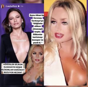 Banu Alkan Instagram - DOĞALLIK ŞART. DOĞAL GÜZELLİK SONSUZA KADAR SÜRER#istanbul #newyork #paris #london #dubai #india #berlin @kyliejenner @banualkanresmi