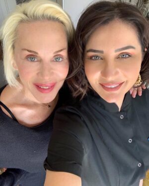 Billur Kalkavan Instagram - Bugün @dr_meral_alacadag elinden @metspharma’nın ürünü 5 nokta lifting’i yaptık. Ameliyat olmadan ufak dokunuşlarla iyi kalmak mümkün. 
.
.
.
#estetik #dokunuş #lifting #doktor #arkadaş #medikalestetik