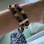 Billur Kalkavan Instagram - Dün @shamanicrafter üşenmedi beni @kocuniversitesihastanesi nde ziyarete geldi. Yine çok güzel hediyeler getirdi. Doğada dolaşıp allahın bize sunduğu güzellikleri toplayıp aksesuarlar yapıyor. İlk fotodaki ağaçın üzerinde kendi topladığı çeşitli kristaller, alacakarga tüyleri ve oklu kirpi okları var. Meğerse türleri yok olmamış, hatta Türkiye’de olduğundan haberim bile yoktu. Doğanın bize verdiği hediyelerin, mucizelerin, canlıların kıymetini bilmek böyle birşey işte. Gidip 30bin $lık çantanın peşinde koşmak, giyemeyeceğin kadar kıyafet almak, ayakkabı koleksiyonu yapmanın ne ruhumuza ne de varoluşumuza bir katkısı yok. Farkına varmak, dünyamızı tanımak, allahın yarattığı herşeye saygı duymaktır gerçek mutluluk. Maalesef insanoğlu uyanana kadar birçok şeyi yok ettik. Ben yine de umutluyum, yavaş da olsa uyanıcaz. Thea Alexander’ın MS 2150 kitabındaki gibi bir dünyaya kavuşacağız inşallah 🙏🏻