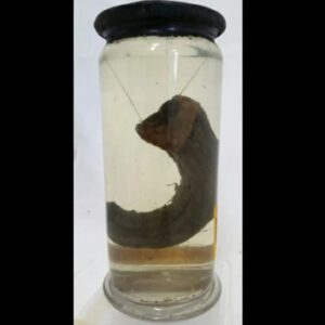 Carla Valentine Instagram - Pop quiz! Apologies for the poor quality of the photo I took, but I've not been at the museum much recently and had to use an old image. Does anyone know what this potted specimen is?
•
It's a "human horn!" (Yes, I thought of Futurama too...)
The medical name for this condition is a cutaneous horn, as cutaneous means "relating to or affecting the skin", and in Latin it's Cornu Cutaneum. 
It may also be called a keratin horn because these unusual growths are made from keratin, which is the same substance that makes up hair & nails in humans, and the oesophagus of rats. They are often benign but can sometimes be malignant and their cause is still unknown. Because they more commonly appear on the face, ears and backs of hands, and in those with fair skin, it's been suggested that there may be a connection with exposure to sunlight but there's also a theory they are related to the wart causing virus HPV. They can be removed fairly easily for those with access to a decent medical system. 
•
As you can see from the 2nd slide, there are still people suffering from this affliction and it's not an archaic condition. The woman in the picture is a 69 yo who watched this horn develop over a period of 20 years. At the time this pic was taken the horn was 17cm long and was removed under general anaesthetic.
•
You can see from the final image that @muttermuseum in Philadelphia has an example of this in the form of a wax moulage. The woman depicted was called Madame Dimanche and she lived in 19th century France. Her horn was 25cm long!
•
We had a sudden period of "summer" here in the UK over the last fortnight so, if these horns are linked to sun damage, this is your reminder to always wear SPF, and if you have any unusual growths or moles that have recently changed in appearance, go and get it checked out! 
•
#cutaneoushorn #medicine #medicalmuseum #pathology #muttermuseum #mutter #protectthemutter #histmed #pathologymuseum #wetspecimen #humanremains #skincancerawareness