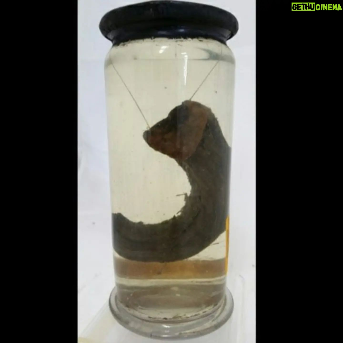 Carla Valentine - 515 Likes - Pop quiz! Apologies for the poor quality of the photo I took, but I've not been at the museum much recently and had to use an old image. Does anyone know what this potted specimen is?
•
It's a "human horn!" (Yes, I thought of Futurama too...)
The medical name for this condition is a cutaneous horn, as cutaneous means "relating to or affecting the skin", and in Latin it's Cornu Cutaneum.
It may also be called a keratin horn because these unusual growths are made from keratin, which is the same substance that makes up hair & nails in humans, and the oesophagus of rats. They are often benign but can sometimes be malignant and their cause is still unknown. Because they more commonly appear on the face, ears and backs of hands, and in those with fair skin, it's been suggested that there may be a connection with exposure to sunlight but there's also a theory they are related to the wart causing virus HPV. They can be removed fairly easily for those with access to a decent medical system.
•
As you can see from the 2nd slide, there are still people suffering from this affliction and it's not an archaic condition. The woman in the picture is a 69 yo who watched this horn develop over a period of 20 years. At the time this pic was taken the horn was 17cm long and was removed under general anaesthetic.
•
You can see from the final image that @muttermuseum in Philadelphia has an example of this in the form of a wax moulage. The woman depicted was called Madame Dimanche and she lived in 19th century France. Her horn was 25cm long!
•
We had a sudden period of "summer" here in the UK over the last fortnight so, if these horns are linked to sun damage, this is your reminder to always wear SPF, and if you have any unusual growths or moles that have recently changed in appearance, go and get it checked out!
•
#cutaneoushorn #medicine #medicalmuseum #pathology #muttermuseum #mutter #protectthemutter #histmed #pathologymuseum #wetspecimen #humanremains #skincancerawareness
