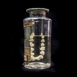 Carla Valentine Instagram - 🧙 It's a necklace of genital warts for the Halloween/Carlaween post today, because many people associate warts with witches! This fascinating specimen of genital warts, strung together before being preserved in the 19th century, comes from @muttermuseum and their fantastic "Memento Mutter" website. Now, before you start wondering if this is some sort of Ed Gein precursor, or the work of a twisted weirdo, the site explains that the reason they're strung together is simple: it's for scientific study. It's easier to compare the size, shape and morphology of warts if they're next to each other rather than all at the bottom of a jar. At the museum I work in we have similar things but rather than strung together they're mounted on a backboard, something that was easier to do when acrylic started to be used for pots - rather than glass - in the 20th century. Also according to the Mutter site, an 8% solution of cocaine would be injected straight into the genitals to dull the pain of the agonising methods used to remove the warts, such as blades and "powerful caustics". 
I know @muttermuseum is worried about it's future at the moment, so if you'd like to find out more about that and/or support them, then do check out their Instagram and @protectthemutter. It's an issue affecting other medical museums too, so your support really matters 🙏
#muttermuseum #pathology #pathologymuseum #histmed #mutter #mementomutter #carlaweencountdown #carlaween #halloweencountdown