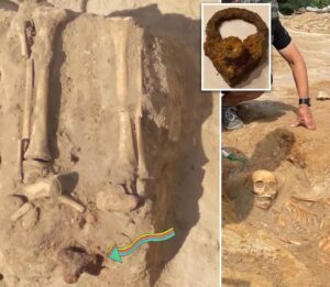 Carla Valentine Instagram - It's not October yet, but it's my birthday and I always feel like that is the start of spooky season for me ☠️ "Vampire Burials": The first 3 images are of a child burial excavated last month in Pień near Poland’s northern city of Bydgoszcz, in what seems to have been a graveyard for "abandoned souls" and the poor. The 400 year old skeleton of a child (aged 5-7 years old) has a triangular padlock on its feet to stop it rising from the dead and is facing downwards to ensure that "if it bites" it bites the soil in the grave. It's shockingly sad because the first thing I thought was "what could a child of 5-7 years of age possibly do to make people think it's cursed in some way, and might rise from the dead"? Archaeologists and historians say sudden death  seemed "suspicious" back then and could account for this fear; or perhaps if the child had a physical abnormality. Either way it seems horrendous that an afflicted child would be buried like this rather than in the graveyard attached to the church. The second 3 pics are of a woman found last year only a few feet away from this child in the same graveyard. Also believed to be a "vampire" burial she had a scythe placed over her neck. The idea is that if she rose from the dead the scythe would cut her head off. You can see the placement of the scythe in the pics: very inventive
#spookyseason #vampireburial #vampireskeleton