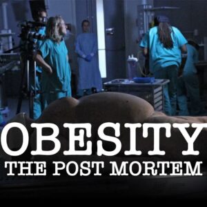 Carla Valentine Instagram - Many moons ago (in 2016) I filmed an autopsy for a TV show called Obesity: The Post Mortem. The idea was to also make other episodes like Alcohol: The Post Mortem and smoking etc but unfortunately it never happened. It was a very interesting and insightful programme, but also very divisive. You can still see it in BBC iPlayer in the UK, it was on Netflix Canada and US at one point, and I'm sure it's even on YouTube. I'll put the link in my Linktree, above, and you can let me know your thoughts (Cadaver was donated for the purpose etc, of course)
#autopsy #autopsytechnician #pathology #obesitythepostmortem
