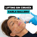 Carla Ballero Instagram - Aplicación de lifting sin cirugía HIFU 4D facial en nuestra amiga @carlaballeroa 🤩🩷 Esta tecnología nos permite realizar un efecto de lifting y de tensión en la piel con posible rejuvenecimiento 😍 Genera cambios mínimos inmediatos posterior a la primera sesión ✅ Obtén resultados naturales sin necesidad de pasar por el quirófano ✅ Comenta aquí tus necesidades y te asesoraremos 👩🏻‍⚕️👇 ¡Agenda tu cita! 📲 569 4252 4673 📍 Las Condes. #dermafemm_clinic👩🏼‍ #hifu #hifu4dfacial #liftingsincirugia #liftingfacial #dermafemm #rostrodefinido #adiosflacidez