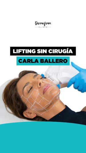 Carla Ballero Instagram - Aplicación de lifting sin cirugía HIFU 4D facial en nuestra amiga @carlaballeroa 🤩🩷

Esta tecnología nos permite realizar un efecto de lifting y de tensión en la piel con posible rejuvenecimiento 😍

Genera cambios mínimos inmediatos posterior a la primera sesión ✅
Obtén resultados naturales sin necesidad de pasar por el quirófano ✅

Comenta aquí tus necesidades y te asesoraremos 👩🏻‍⚕️👇

¡Agenda tu cita!
📲 569 4252 4673
📍 Las Condes.

#dermafemm_clinic👩🏼‍
#hifu #hifu4dfacial #liftingsincirugia #liftingfacial #dermafemm #rostrodefinido #adiosflacidez