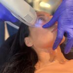 Carla Harvey Instagram - I am obsessed with skin and when I find something that works I like to scream it from the rooftops. I love treatments that preserve skin texture and tighten especially when they are safe for darker skin tones like mine (traditionally I hyperpigment) and Lindsey at @shotbar_chicago has alllll the cutting edge technology. My regimen with Lindsey is once a year sofwave (the best) and I’ve just added in a series of tixel around my eyes. Tixel is a game changing non invasive procedure that uses thermo mechanical action technology to deliver results like deep skin chemical peels and intensive laser treatments without the downtime or risk of PIH. I swear, these treatments are the fountain of youth! Pair them with a good skin care routine (vitamin c, sunscreen and retinol are musts) and drink your water 💦💦💦you'll thank me when you're in your forties and beyond😜#selfcaresunday #skin #sofwave #tixel