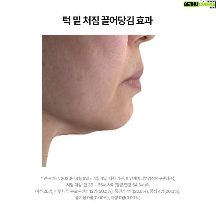 Choi Hee Instagram - ๐๏ธ KYYB ์คํ ์๋ด ๐๏ธ ๋์ด๋ ํฑ๋ฐ, ๋ฌด๋์ง ์ผ๊ตด๋ผ์ธ, ์ด์คํฑ, ์์ฃผ ๋ถ๋ ์ผ๊ตด์ด ๊ณ ๋ฏผ์ด์
จ๋ค๋ฉด ํต์ NaDCํฌ๋ฆผ์ ์ถ์ฒํฉ๋๋ค. ๊ทธ๋์ ํผ๋ถ์ ์ง์ ์นจํฌ, ํก์์ํฌ ์๊ฐ ์์ด ์ฃผ์ฌ๋ก ๋ง์๋ ์ง๋ฐฉ๋ถํด์ฑ๋ถ NaDC์ฑ๋ถ์ ์นด์ด์คํธ ๋ฐ์ฌ์ง์ ๋ชจ์์์ค ๊ธฐ์ ๋ก ์ด์ ๋ ํผ๋ถ๋ฅผ ํตํด ํก์์ํฌ ์๊ฐ ์์ด์. ์ ๋ ๋๋ฌด ๋ฐ์๊ณ ๋ ์ฃผ์ฌ๋ ๋ถ๊ณ ๋ฉ๋ค๊ณ ํด์ ์์ ์ด ๊ณ ๋ฏผ๋์๋๋ฐ ํต์ ๋ง๋๊ณ ๋์๋ ๋งค์ผ๋งค์ผ ํธํ๊ฒ ๊ด๋ฆฌํด์ฃผ๊ณ ์์ด์. ํ๊ธฐ๋ค์ ๋ณด์๋ฉด ์์๊ฒ ์ง๋ง ์ ๋ง ์ผ๊ตด๋ผ์ธ์ด ๋ง์ด ์กํ๋ค, ๊ณ ๋ฏผ์ด๋ ํฑ์ด์ด ์ค์๋ค, ์ผ๊ตด ๋ถ๊ธฐ๊ฐ ๋น ์ก๋ค ๋ฑ๋ฑ์ ์ฐ ๊ธ์ ์ ์ธ ํ๊ธฐ๋ค์ด ๋๋ถ๋ถ์
๋๋ค. ์ ๋ ์ ๊ฐ ํ๋งคํ๋ ์ ํ์ ๊ตฌ๋งคํ์
์ ๋ชจ๋ ๋ง์กฑํ๊ณ ์ ์ฌ์ฉํ์
จ์ผ๋ฉด ์ข๊ฒ ์ด์. ๊ฐํน ํ๊ธฐ์ค์ (๊ทธ๋ฐ๋ฐ ์ ๋ง ํ๊ธฐ ๋น์จ ์ค์ ์์ฃผ ๋๋ฌธ๊ฒ๋ ์ ๊ธฐํด์. ๋ณดํต ๊ธ์ ํ๊ธฐ์ ๋ถ์ ํ๊ธฐ๊ฐ ์์ฌ์๊ธฐ ๋ง๋ จ์ธ๋ฐ, ํต์ ๋ถ์ ์ ์ธ ํ๊ธฐ๋ ๊ทน์์๋๋ผ๊ตฌ์..) ํจ๊ณผ๊ฐ ์๋ค. ๋ผ๊ณ ํ์๋ ๋ถ๋ค๋ ๊ณ์
จ์ด์. ์ ๋ ์ด๋ฐ ์ง๋ฐฉ์ ๋ถํดํด์ค๋ค๋ ์
๋ฃฐ๋ผ์ดํธ ํฌ๋ฆผ๋ถํฐ ์ด๊ฒ์ ๊ฒ ์๋์ด์ ์์ ๋ถํฐ ์ญ์ฑ ์ฌ์ฉํด์๋๋ฐ์.. ์ด๋ฐ ๊ธฐ์ ์ ์ฒ์ ๋ด
๋๋ค. ์ฃผ์ฌ๋ก ๋ง๋ ํ์คํ ์ง๋ฐฉ๋ถํด์ฑ๋ถ์ ํผ๋ถ์ ๋ฃ๋๋ฐ, ์๋๋ ํผ๋ถ ๋ํฌ๋ก๋ ์๋ค์ด๊ฐ๋ ๊ทธ ์ฑ๋ถ์ ๋ชจ์์์ค ๊ธฐ์ ๋ก ๋ถ์๊ตฌ์กฐ๋ฅผ ์ฌ๋ฐฐ์ดํด ๋ฃ์ด์ฃผ๋ ์ ํ. ์ ๋ ์ด๋ ๊ฒ ์ฑ๋ถ๊ณผ ๋งค์ปค๋์ฆ์ด ํจ๊ณผ๊ฐ ์์ผ๋ฉด ์ฌ์ค ๋ค๋ฅธ ์ ํ๋ค์ ๋์ฑ ํจ๊ณผ๊ฐ ์๋ค๊ณ ์๊ฐํด์. ์ง๋ฐฉ์ธํฌ๋ฅผ ํ๊ดดํด์ฃผ๋ ์ฑ๋ถ์ด ๋ค์ด๊ฐ์๋๋ฐ ๋ฌผ๋ก ,, ์ฐ๋ฆฌ๊ฐ ๋ ์ ๋จน๊ณ ์ง๋ฐฉ ์ธํฌ๋ฅผ ์๊พธ ํฌ๋ํฌ๋ ์ด ์ฐ์ฐ๋ ๊ทธ ์๋๊ฐ ๋ ๋น ๋ฅด๋ค๋ฉดโฆ^^ ํจ๊ณผ๋ ์์ ์๋ ์์ด์. ํ๊ดดํ๋ ์๋๋ณด๋ค ์ฐ์ฐ๋ ์๋๊ฐ ๋ ๋น ๋ฅด๋ฉด์ โฆใ
ใ
๊ทธ๋์ ํ์์๋๋ก ๊ด๋ฆฌํ์๋ฉด์ ์ดํฌ๋ฆผ์ ๊ผญ ์จ๋ณด์ธ์. ํ๊ธฐ์ ๋์ณ๋๋ ์ฐ ๊ฐ์ฆ ํ๊ธฐ๋ค์ฒ๋ผโฆ ๋ญ๊ฐ ์ผ๊ตด๋ผ์ธ์ด ์ ๋ฆฌ๋๊ณ , ๋ฌด๋์ก๋ ๋ผ์ธ์ด ์๋ป์ง๊ณ , ๋ฉด์ ์ด ์ค์ด๋ค๊ณ ํ๋ ํจ๊ณผ๋ฅผ ๋๋ผ์ค ์ ์์ ๊ฑฐ์์. ๊ทธ๋ฆฌ๊ณ ๋ฌด์๋ณด๋ค ๊พธ์คํจ์ด ๋ต์
๋๋ค! ๊ทธ๋ฆฌ๊ณ 5๋๋
ธ์ฐจ์ (ํ์๋ฃจ๋ก ์ฐ ์ฐํ)์ด ํจ๊ป ๋ฌถ์ฌ์๋ ๊ตฌ์ฑ์ด ์๋๋ฐ์. ์ ๋ ์ด ๊ตฌ์ฑ์ ๊ฐ์ฅ ์ถ์ฒํด์. ์๋๋ฉด ์ด ์ฐํ์,,, ํต์์ ์ง๋ฐฉ๋ถํดํฌ๋ฆผ์ด ์ด๋ ๊ฒ ๋จ๊ธฐ ์ด์ ์ ๋ถ๋์ 1์๋ฅผ ์ฐจ์งํ๊ณ , ๋๋ฌด ๋ง์ ๋ถ๋ค์ด ์ฌ๊ตฌ๋งค, ๋ ์ฌ๊ตฌ๋งคํด์ฃผ์๋ ์ ํ์ด๊ฑฐ๋ ์. ๋งค์ปค๋์ฆ์ ๋๊ฐ์ต๋๋ค. ์ฃผ์ฌ์์ ์์ ๊ณ ๋ถ์ ํ์๋ฃจ๋ก ์ฐ์ ๋ฃ์ต๋๋ค. ์๋, ํ์๋ฃจ๋ก ์ฐ์ ์๋ ๊ณ ๋ถ์์ด๊ณ ๊ทธ๊ฒ ๋ ํจ๊ณผ๊ฐ ์ข๊ฑฐ๋ ์. ๊ทธ๋ฐ๋ฐ ์ฃผ์ฌ ์ธ์๋ ํผ๋ถ์ ๋ค์ด๊ฐ์ง ๋ชปํด์ ์ ๋ถ์๋ก ๊ทธ๋์์ ์ชผ๊ฐฐ์ต๋๋ค. ๊ทธ์น๋ง ์ฐ๋ฆฌ์๊ฒ๋ ๋ชจ์์์ค ๊ธฐ์ ์ด ์์ง์. ๋ชจ์์์ค๊ธฐ์ ๋ก ๊ณ ๋ถ์ ํ์๋ฃจ๋ก ์ฐ์ ์ฐํ๋ก ๋ฃ์ด์ค๋๋ค. ์ ๋ง ๋์ ์์์ด ์์ฅ ํก์๋๊ณ ์, ์ฌ๋ฌ๋ถ์ด ๊ฐ์ง๊ณ ๊ณ์๋ ์ฒซ ๋จ๊ณ์ ๋ํฌํด์ฃผ์๋ฉด ๋ฉ๋๋ค. ์๊ฑด์กฐ ๊ณ ๋ฏผ์ด์ ๋ถ๋ค์ ๋ฌผ๋ก ์ด๊ณ ์.. ํผ๋ถ๋ฅผ ๊ตฌ์ฑํ๋ ์ฃผ์์ฑ๋ถ์ธ ํ์๋ฃจ๋ก ์ฐ์ด ์ฑ์์ง์ผ๋ก์จ ํ๋ ฅ๊ณผ ํค์๋ ๋์์ ๋ฐ์ผ์๋ ๋ถ๋ค์ด ์ง์ง ๋ง์์. ์ด๊ฑด ์ฐ ๊ทธ๋ถ๋ ๊ทธ๋ถ์ฐ์ด๋ผ ์ค๋ช
์ ๋ชป ๋งํ์ง๋ง, ๋ํ๋ฏผ๊ตญ ํ์ฌ ๊ฐ์ฅ ํซํ ๋ฉ์ดํฌ์
์ํฐ์คํธ๋ถ์ด ์ง์ ๊ตฌ๋งคํ์
์ ์์ด๋ ๋ฉ์ดํฌ์
ํ ๋ ์ฌ์ฉํ์๋ ์ ํ์ด์์. ๊ทธ๋ถ์ ๊ณต๋ณ์ ๋ด์ ๋ฏธ์คํธ๋ก ์ฌ์ฉํ์ ๋ค๊ณ ํด์. ์ด ์ ํ ๋ฐ๋ฅด๊ณ ์๋ฐ๋ฅด๊ณ ๋ฉ์ดํฌ์
๋จน๋ ๋๋๋ ์์ ๋ฌ๋ผ์. ํต์ ๋จ๋
์ฒซ ๊ณต๊ตฌ์
๋๋ค! ํ๋ฒ๋ ๊ณต๊ตฌ๋ฅผ ์งํํ ์ ์ด ์๋ ๋ธ๋๋์ด๊ณ , ์์ผ๋ก๋ ๊ณต๊ตฌ๋ฅผ ์์ฃผ ์งํํ ๊ณํ์ด ์ ํ ์์ด์. ์ ๋ง ์ข์ ๊ธฐํ๋ก ๊ณต๊ตฌ๋ฅผ ๊ฐ์ง๊ณ ์ค๊ฒ ๋์๊ณ , ์ญ์ ์ํด์ ๋ซ์ด์จ ๋ธ๋๋์
๋๋ค. ํ ์ธ์จ๋ ๋๋ฌด ์ข์ผ๋, (์ธ์ผ์ ์ํด์ ๊ธฐ์กด ๊ณ ๊ฐ๋ถ๋ค์ ๋ค ์ ๊ฐ์ฃผ๊ณ ๊ตฌ๋งคํ์
จ์ด์.) ์ด ๊ธฐํ ์ฑ๊ฒจ๊ฐ์ธ์๐ค
