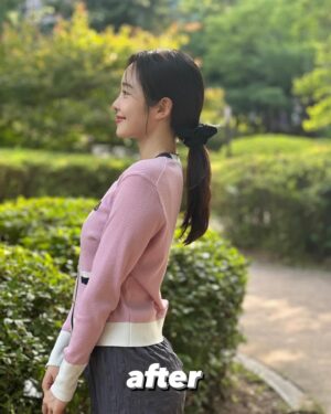 Choi Seol-hwa Instagram - #공구예정 비포 에프터 가져왔어요..!
일부러 포토샵 하나도 안했어요🧸
진쫘 보여주고싶지 않은 모습들이지만..😊
저는 볼꺼짐도 있었고 광대에 살이 많은 편이라 무거워서 쳐짐도 좀 있고 턱 하부에 뭉통거리는 살들도 있었어요!
그래서 소개 받아서 작은얼굴 마사지 받으러 갔다가 하이퍼라는 레이저리프팅 기계가 있는데 울세라와 비슷한 효과가 있는데 훨씬 저렴해서 두가지 관리 한 번이 받고 턱 하부 살과 볼꺼짐 개선돼서 바로 그 다음주에 또 받으러 갔잖아요!

효과가 너무 좋은게 어제 엄마가 제 얼굴 오랜만에 보고 변했다고 하도라고요.
진짜 200% 만족‼️

어제까지 네고 하다가 최대 33%까지 할인 받아왔어요😍😍 너무 다행이에요ㅠ 저에게도🩵
1-2주에 1회씩 무조건 가야겠어요!

위치는 청담동이에요!
황금희 에스테틱 작은얼굴관리 하어퍼 레이저리프팅 6/3~6/7까지 공구하니까 
관리하는거 좋아하시는 분들 무조건 겟하셔야할 타이밍🩵