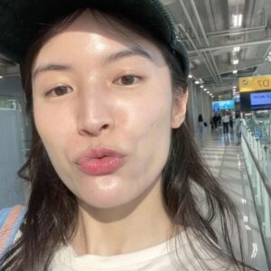 Chollatorn Pratchyaroongroj Instagram - กว่าจะกล้ากลับมาหน้าสดออกนอกบ้าน โปรดชมวีดีโอที่ 3 แล้วจะรู้สาเหตุ 🥹

ช่วงตุลาปีที่แล้ว เป็นช่วงที่ท้อแท้เพราะสิวขึ้นเต็มแก้มเลย และพอหายมันก็ทิ้งรอยแดงไว้เต็มไปหมด 
แต่เมื่อขึ้นมาแล้วก็ต้องทำใจ ต้องรักษา ค่อยๆเคลียร์ไปทีละขั้นตอน ล่าสุดไปเจอทางลัดรักษาสิวที่ @freshcodeclinic 
ฝีมือพี่ๆที่กดสิวให้ที่นี่คือยกให้เป็นอันดับต้นในใจ แบบว่าถูกองศาถูกใจจริงๆ พวกอุดตันที่เตรียมอักเสบหายหมด จากนั้นก็ทำ Dual Yellow ลดรอยแดงไปสองครั้งช่วงพ.ย.และธ.ค. นับจากตุลาที่เป็นช่วงพีคของสิว ผ่านมาประมาณ 3 เดือน จนวันนี้เหลือรอยแค่รูปท้ายๆ พอใจมากเลย ไม่ต้องเมคอัพหนักๆปิดสิวแล้ว วันที่ไม่เจอใครมากก็แค่กันแดดแล้วจบ ชีวิตกลับมาง่ายขึ้นอีกครั้ง นอกจากเมยตูแล้วก็ Dual Yellow นี่แหละที่ช่วยให้เรามั่นใจ ผลพลอยได้คือหน้าเงาผิวละเอียดขึ้นด้วย ✨

จริงๆก็พยายามหาสาเหตุว่าทำไมอยู่ๆสิวระเบิดขนาดนั้นจนคิดว่าน่าจะเพราะเปลี่ยน remover จาก micellar เป็น cleansing milk น่าจะไม่ถูกโฉลกกับเรา ตอนนี้กลับมาใช้ micellar เหมือนเดิมแล้วดีขึ้นแล้วค่ะ ขอเป็นกำลังใจให้คนเป็นสิวทุกคน เดี๋ยวมันก็ผ่านไปนะ พยายามแกะรูทีนตัวเองให้ได้ว่าใช้อะไรผิดไป และหาทางรักษาอย่างถูกวิธี ปรึกษาคุณหมอด้วยจะได้หายไวไวค่ะ 🫶🏻