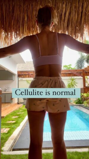 Cici Coleman Instagram - I was trying to do a video on normalising cellulite; however, the cat decided to judge me on my dancing, and then I felt self-conscious, so I cut it short 🤣

Even if cats judge, the message remains: cellulite is normal. I train 4-5 times per week, and I eat well, and I still have it. 
It’s normal people. 

Don’t compare yourself to Instagram-filtered pictures. They aren’t reality.

@cici_onlinecoaching