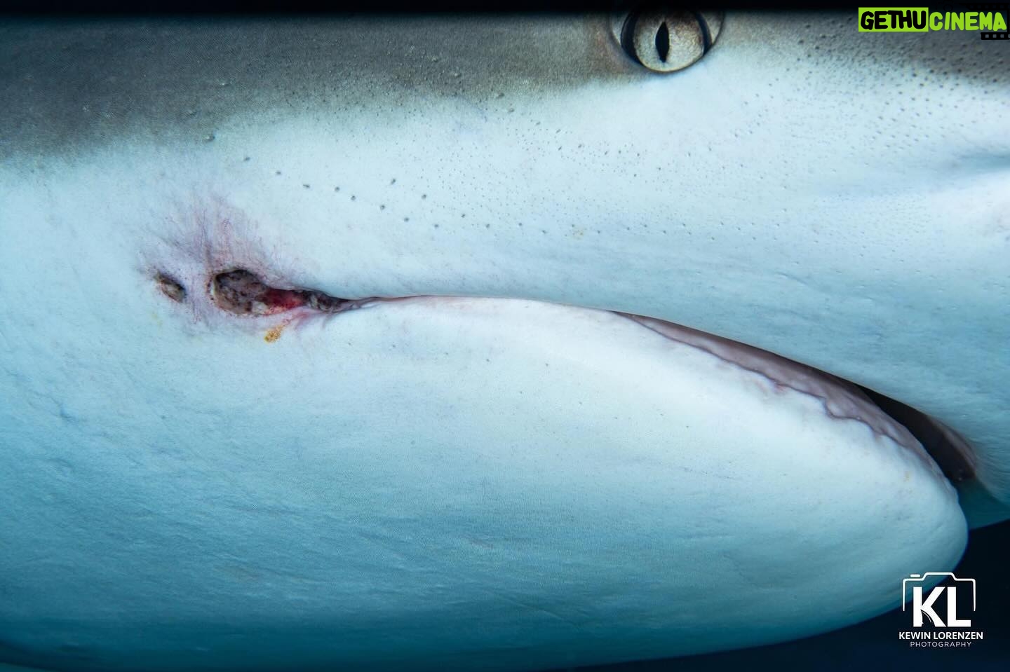 Cristina Zenato - 1.1K Likes - Have you tried to google if fish, and specifically sharks feel pain?
On the internet there is a huge amount of disparete information.
It is very confusing and people claim that not having the same receptors we have makes these animals not feel pain.
But pain (for the lack of better word) is a necessity of survival, it is a warning, it is a learning step for many creatures.
Pain might not feel the same to sharks or fish, but it is present.
I have seen it first hand, many times over. I have watched these sharks struggling to keep a fish in their mouth, dive into the sand to remove the hook, suffering of long term infections caused by the lingering lines, twiching their fins trying to dislodge the embedded hooks and the pulling caused by some of them.
Direct observation of a repeated behavior, provides in this case, as many others, a more reliable information, and although sharks might not feel the way we do, they still feel their definition of pain. It is time we understand that not everyone has to be measured according to our standards and levels, as not everyone is a mammal, walking on two legs.
Image of Nacho with a residual infection left behind by a hook I was able to remove by @kewinlorenzen
@isotta_underwater_housings