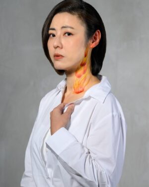 Cynthia Koh Instagram - It has been 10 years since my mum had shingles. Shingles had left her with hearing loss in her left ear. I can still remember her moaning about the constant burning sensation in her ears - like her ears were on fire.(1)

The body art on my ear and neck is meant to represent the pain and burning sensation felt by my mum. I’m not my mum but as her daughter and caregiver, I feel her pain. It was heartbreaking to see her suffer like that.

Even after the shingles in her ear had cleared, the left side of her face was still affected. She couldn’t fully close her eyes and the left side of her face was drooping affecting her speech. She had to undergo a year of regular physiotherapy and performed exercises at home.

Today, my mum is back to her bubbly self even though she can’t hear well in her left ear. As her daughter and caregiver, I am happy to see her back to her normal self but the shingles episode.

This is my shingles story. Don’t let it be yours.

If you have a shingles story to share, please share your story in the comments below. Please tag your story #stopshinglessg
Together, our stories can make a difference.

Did you know that over 90% of adults aged 50 and above in Singapore carry the chickenpox virus?(2) Furthermore, 1 in 3 adults will develop shingles at some point in their lifetime.(3)* However, there are ways to protect yourself against shingles. 

To find out more, please visit www.stopshingles.com.

Speak to your doctor about shingles prevention before it is too late.

This is a health message brought to you by GSK
For further information, please consult your doctor
All images used in this material are for illustration purposes only
©️ 2024 GSK group of companies or its licensor
NP-SG-HZU-SMP-240017, Date of Approval: February 2024
1.Chen LK;BMC infectious diseases;2017;17;1-39. 2. Fatha N, et al. Int J Infect Dis. 2014;22:73-77. 3. CDC (US). Morbidity and Mortality Weekly Report. Prevention of Herpes Zoster.
*Based on US population data