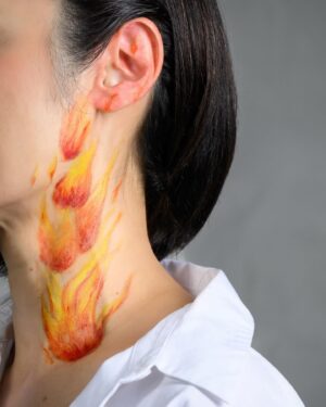Cynthia Koh Instagram - It has been 10 years since my mum had shingles. Shingles had left her with hearing loss in her left ear. I can still remember her moaning about the constant burning sensation in her ears - like her ears were on fire.(1)

The body art on my ear and neck is meant to represent the pain and burning sensation felt by my mum. I’m not my mum but as her daughter and caregiver, I feel her pain. It was heartbreaking to see her suffer like that.

Even after the shingles in her ear had cleared, the left side of her face was still affected. She couldn’t fully close her eyes and the left side of her face was drooping affecting her speech. She had to undergo a year of regular physiotherapy and performed exercises at home.

Today, my mum is back to her bubbly self even though she can’t hear well in her left ear. As her daughter and caregiver, I am happy to see her back to her normal self but the shingles episode.

This is my shingles story. Don’t let it be yours.

If you have a shingles story to share, please share your story in the comments below. Please tag your story #stopshinglessg
Together, our stories can make a difference.

Did you know that over 90% of adults aged 50 and above in Singapore carry the chickenpox virus?(2) Furthermore, 1 in 3 adults will develop shingles at some point in their lifetime.(3)* However, there are ways to protect yourself against shingles. 

To find out more, please visit www.stopshingles.com.

Speak to your doctor about shingles prevention before it is too late.

This is a health message brought to you by GSK
For further information, please consult your doctor
All images used in this material are for illustration purposes only
©️ 2024 GSK group of companies or its licensor
NP-SG-HZU-SMP-240017, Date of Approval: February 2024
1.Chen LK;BMC infectious diseases;2017;17;1-39. 2. Fatha N, et al. Int J Infect Dis. 2014;22:73-77. 3. CDC (US). Morbidity and Mortality Weekly Report. Prevention of Herpes Zoster.
*Based on US population data