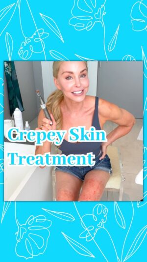 Darnell Cox Instagram - Over 40? Over 50? And bothered by Crepey Skin? 

Microneedling at-home is my top treatment for crepey skin! 

Microneedling creates microtraumas which call on our own body to create collagen and elastin.

Microneedling reduces⬇️fine lines and wrinkles, tightens skin, and resurfaces. 

At 55 years old, I have crepey skin, and it’s not just on my eyelids 😳, but I microneedle like a champ, targeting🎯every crepey area!

You can too! 

➡️ Join the LIVE YOUNG IG subscriber Club for exclusive content and weekly microneedling tutorials. 🤗💕

➡️ Comment or DM me “Skincare” for a free, printable, at-home healthy aging gadgets monthly treatment schedule when you sign up for my weekly newsletter. 💌

#Over50SkinCare #TightenSkin #Microneedling #CrepeySkin