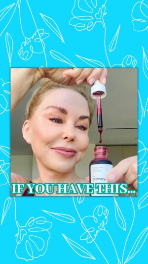 Darnell Cox Instagram - SKINCARE CHEAT SHEET:

👉🏼If you have crow’s feet wrinkles, then use a retinoid. 

👉🏼If you have large pores, then use pore-reducing toner.

👉🏼If you have dull skin, then use vitamin C serum.

👉🏼If you have eye bags, then use caffeine solution.

🌟Want to take care of your skin as you age and look younger longer?

DM me “PROTOCOL” to get access to the Ultimate Anti-Aging Skincare Protocol!🌟

#LookYoungerLonger #EyeBags #WomenOver50 #Over50Skincare