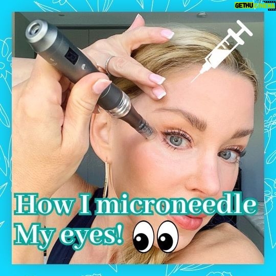 Darnell Cox - 1.5K Likes - 🪡🥇Microneedling is my top at-home treatmemt to reduce fine lines & wrinkles as well as crepey eyelid skin!
👩🏫Here’s how I do it:
👉 Device: I use the Dr Pen M8 and a new sterile 16 pin cartridge. Check out my Amazon store for the device. Other Dr Pen models are fine, but try to find a needle number that is close to 16 pins. I found that it is an all-over great needle cartridge to use on all body parts, including the eyes.
👉 Calibrations: Needle depth .25mm, Speed 1.
👉 Products used: I coat the area with Hyaluronic Acid to create a slip so the device glides easily over the skin.
👉Technique used: I use a combo of swirling technique stamping technique, staying on the occipital bone.
👉 Post Care: continue to coach the area with hyaluronic acid for a few hours post treatment, then follow with a thin layer of Aquaphor.
👉 Healing time varies depending on health, post care protocol, and lifestyle factors.
👩🏼⚕️Want to Speed Healing time? 👇
🤩Double up on your collagen supplement (DM me “COLLAGEN” for my fav)
🚨Blast the treated area with Red Light therapy to speed healing (DM me Red Light for my favorites).
😃 DM me MICRONEEDLING for my FREE Microneedling guidebook that gives you step-by-step, instructions, as well as safety protocols, different calibrations for various body, parts, and a post care protocol to speed healing.
#microneedling #50plusskincare #youngerlookingeyes #tightenskin
