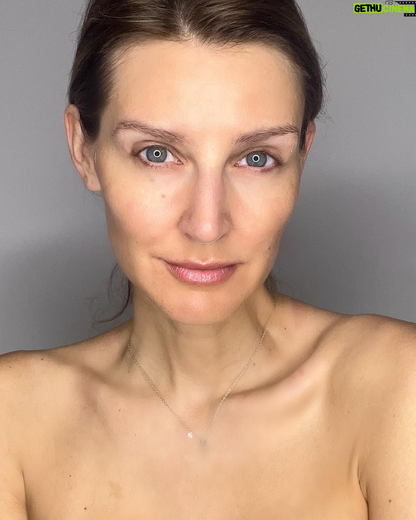 Diana Pereira - 1.4K Likes - No makeup, no filter , apenas o tratamento laser da @dra.ritaseco na @galerieclinic , nem todos os tratamentos são iguais e todos podemos reagir de maneiras diferentes , por isso aconselha-te sempre com um profissional qualificado . A minha pele só confio à dr Rita Seco . A primeira foto foi o resultado final . A outras foi a evolução.
