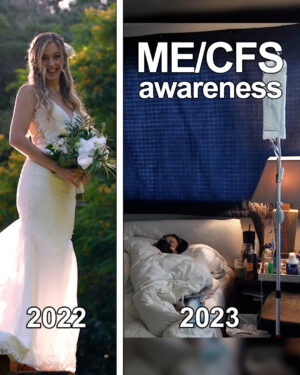 Dianna Cowern Instagram - May 12th was ME/CFS awareness day. Dianna Cowern's ME/CFS was triggered last year after she contracted COVID on her honeymoon. 1 year later she is bed-ridden 24 hours a day. Kyle takes care of her full time, and this week they are celebrating the 1 year anniversary of their wedding.

Millions of Americans continue to suffer from ME/CFS, and an estimated tens of millions of people around the world are affected. The Physics Girl office has been closed down, and her science exploring Youtube channel is on hold.

While ME/CFS awareness week continues, we'll keep Dianna and those suffering from chronic fatigue in our hearts. The road to recovery is long, hang in there Dianna.

#MECFS #notaflu #longcovid #chronicfatigue #CFS